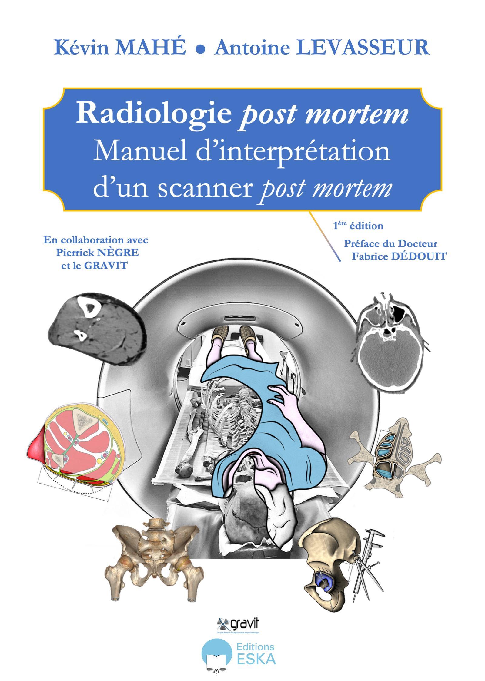 Radiologie post mortem