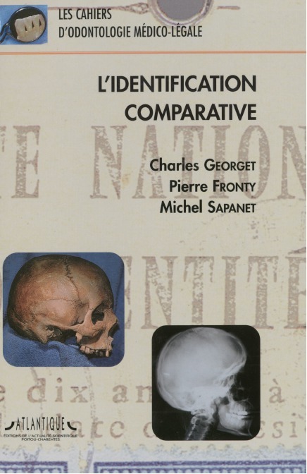 Les cahiers d'odontologie médico-légale : L'identification Comparative
