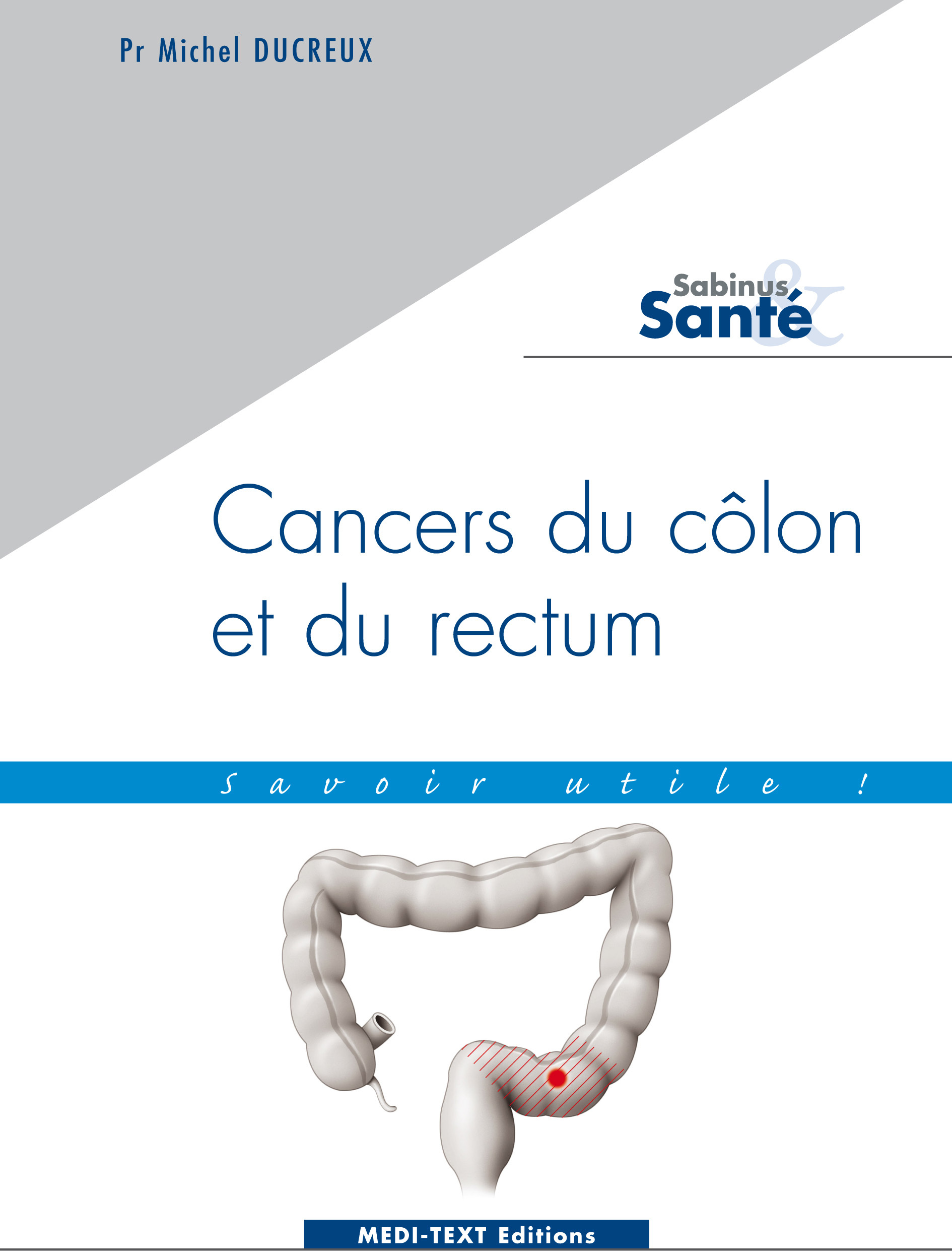 CANCERS DU CÔLON ET DU RECTUM : savoir utile !