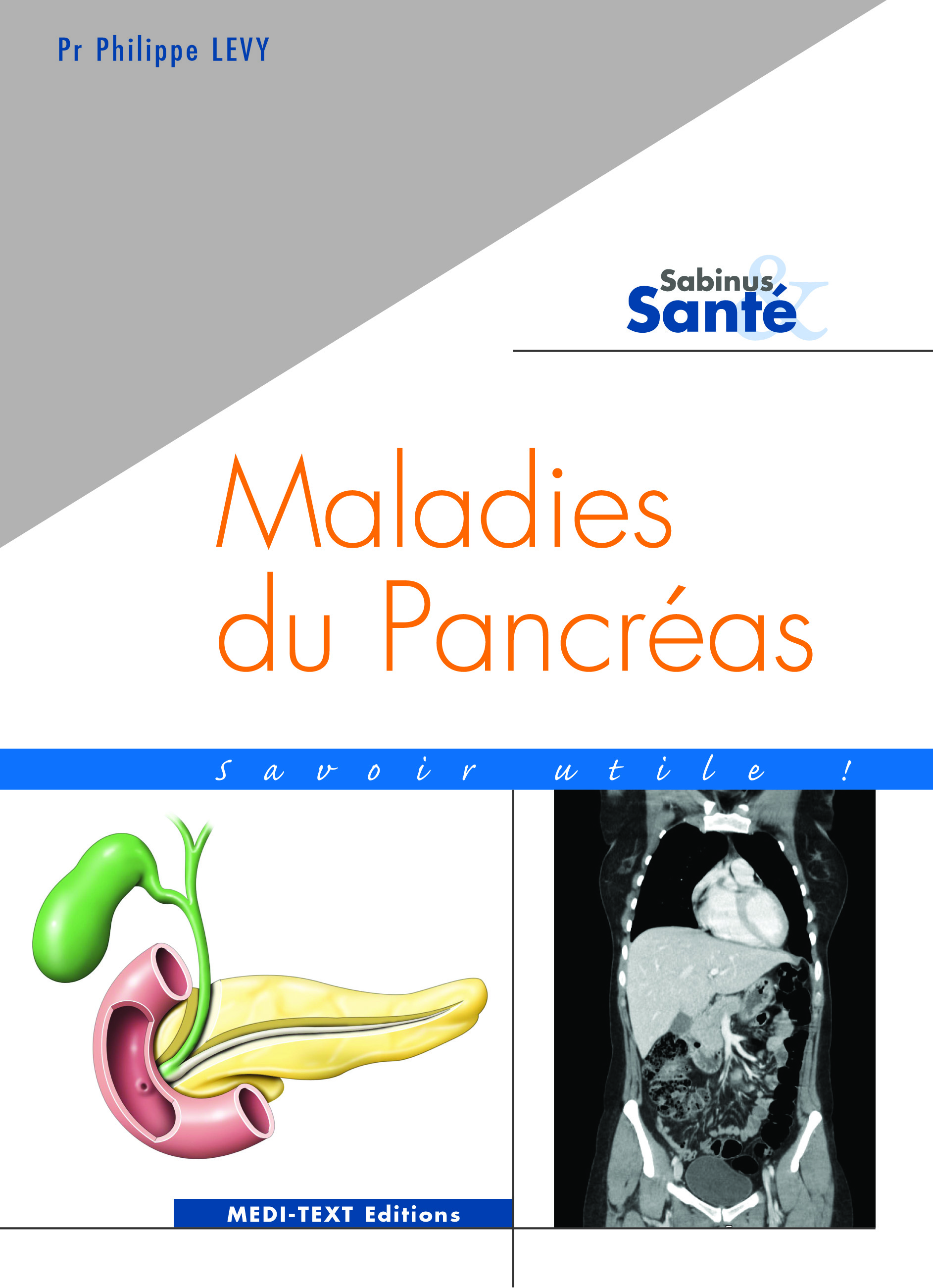 MALADIES DU PANCRÉAS : savoir utile ! (pancréatites et cancers du pancréas)