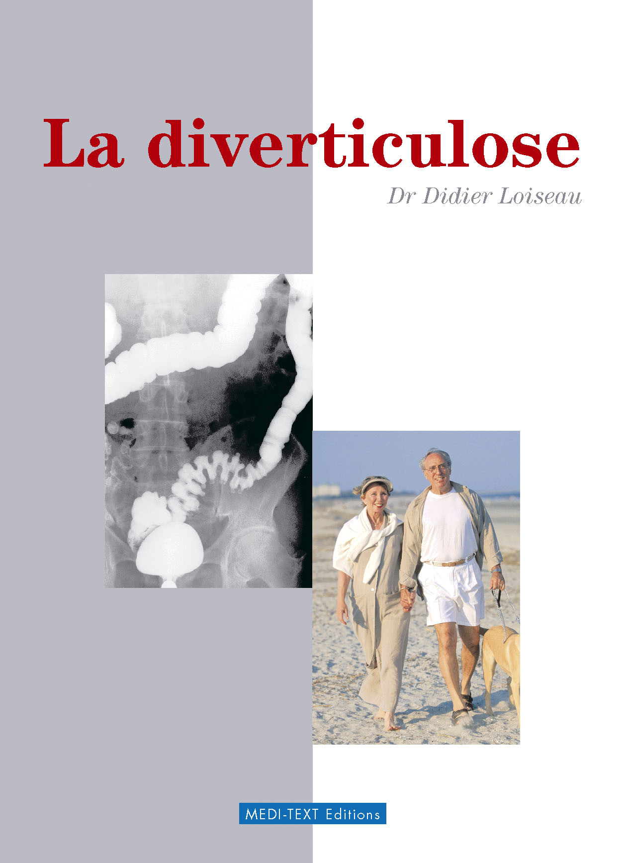 LA DIVERTICULOSE