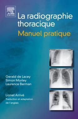 La radiographie thoracique. Manuel pratique