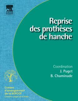 Reprise des prothèses de hanche