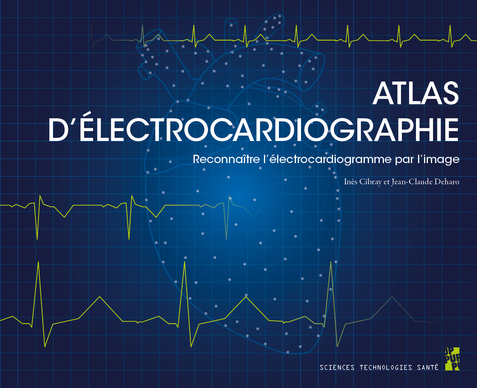 Atlas d’électrocardiographie