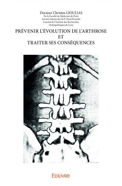 Prévenir l'évolution de l'arthrose et traiter ses conséquences