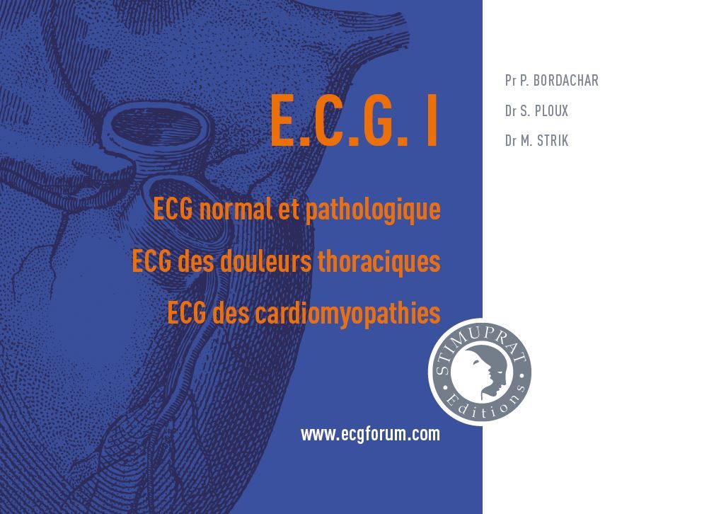 ECG I : ECG normal et pathologique, ECG des douleurs thoraciques, ECG des cardiomyopathies