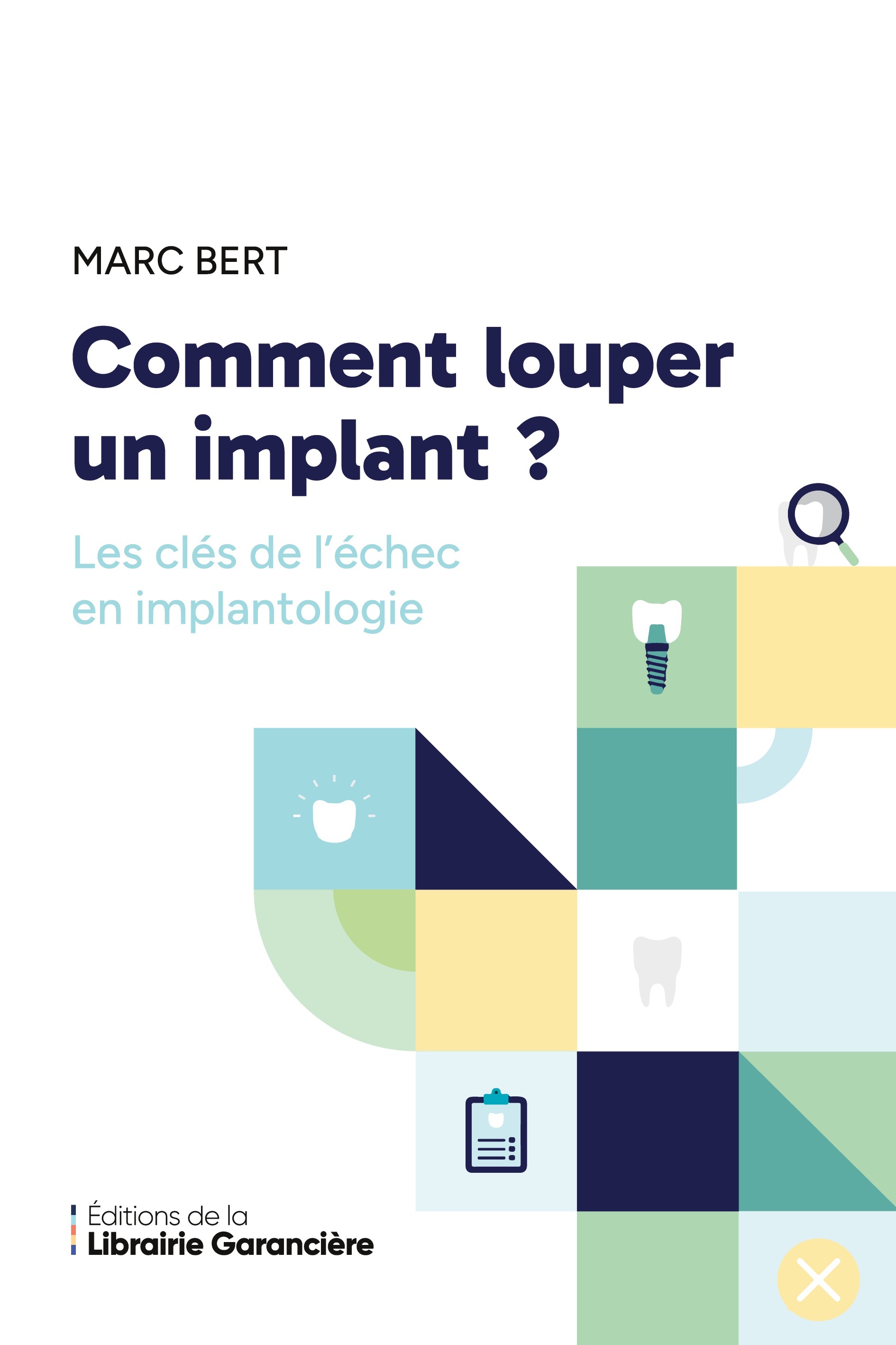 Comment louper un implant
