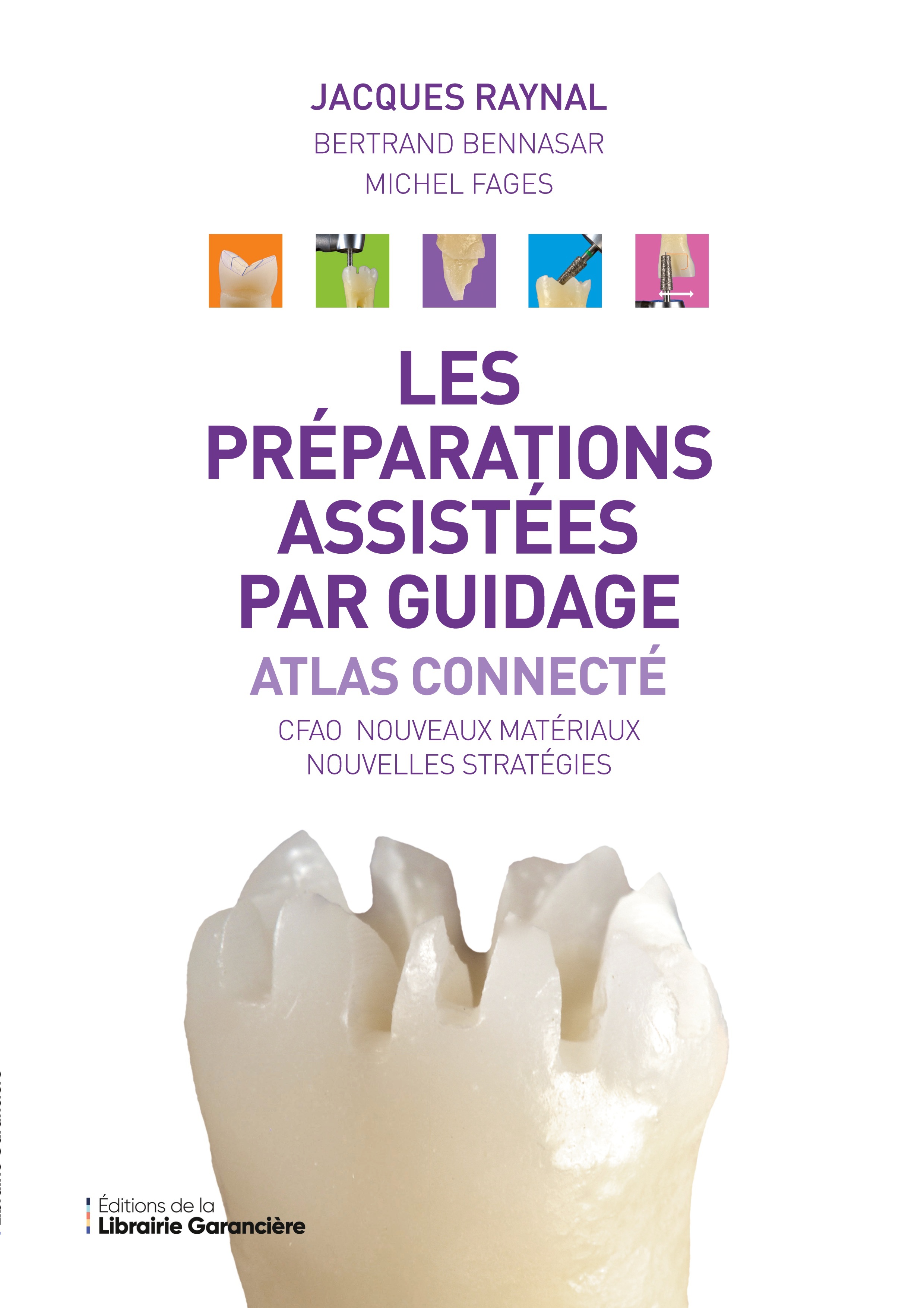 Les préparations assistées par guidage