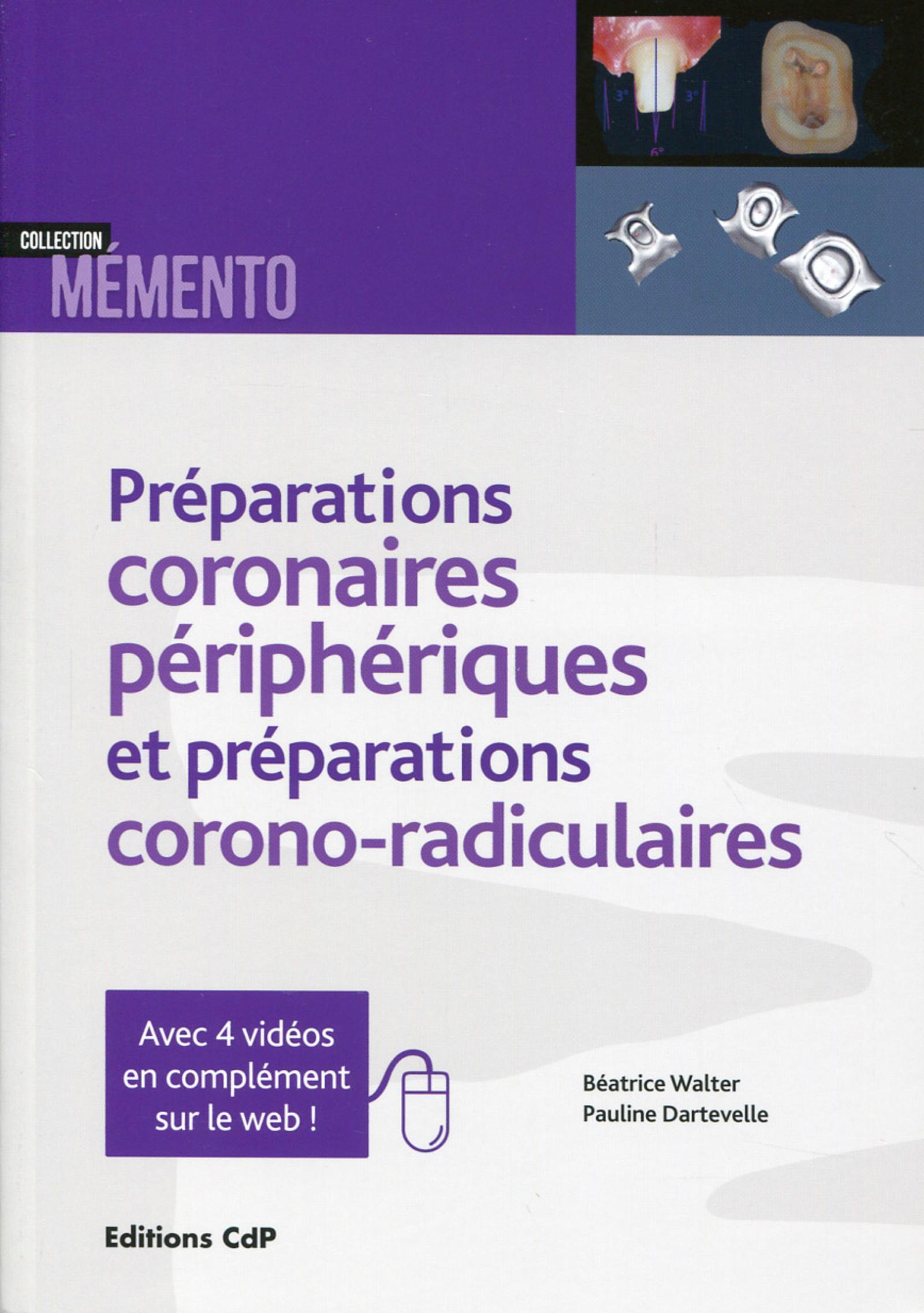 Les préparations coronaires périphériques et préparations corono-radiculaires