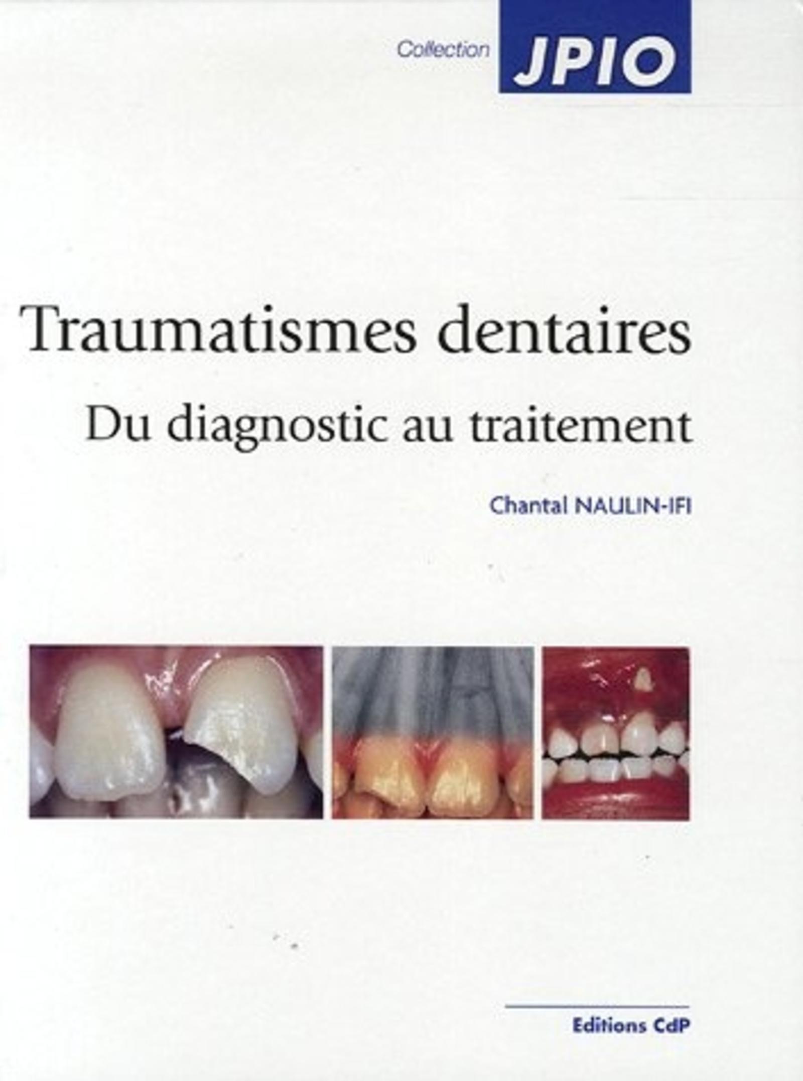 TRAUMATISMES DENTAIRES DU DIAGNOSTIC AU TRAITEMENT