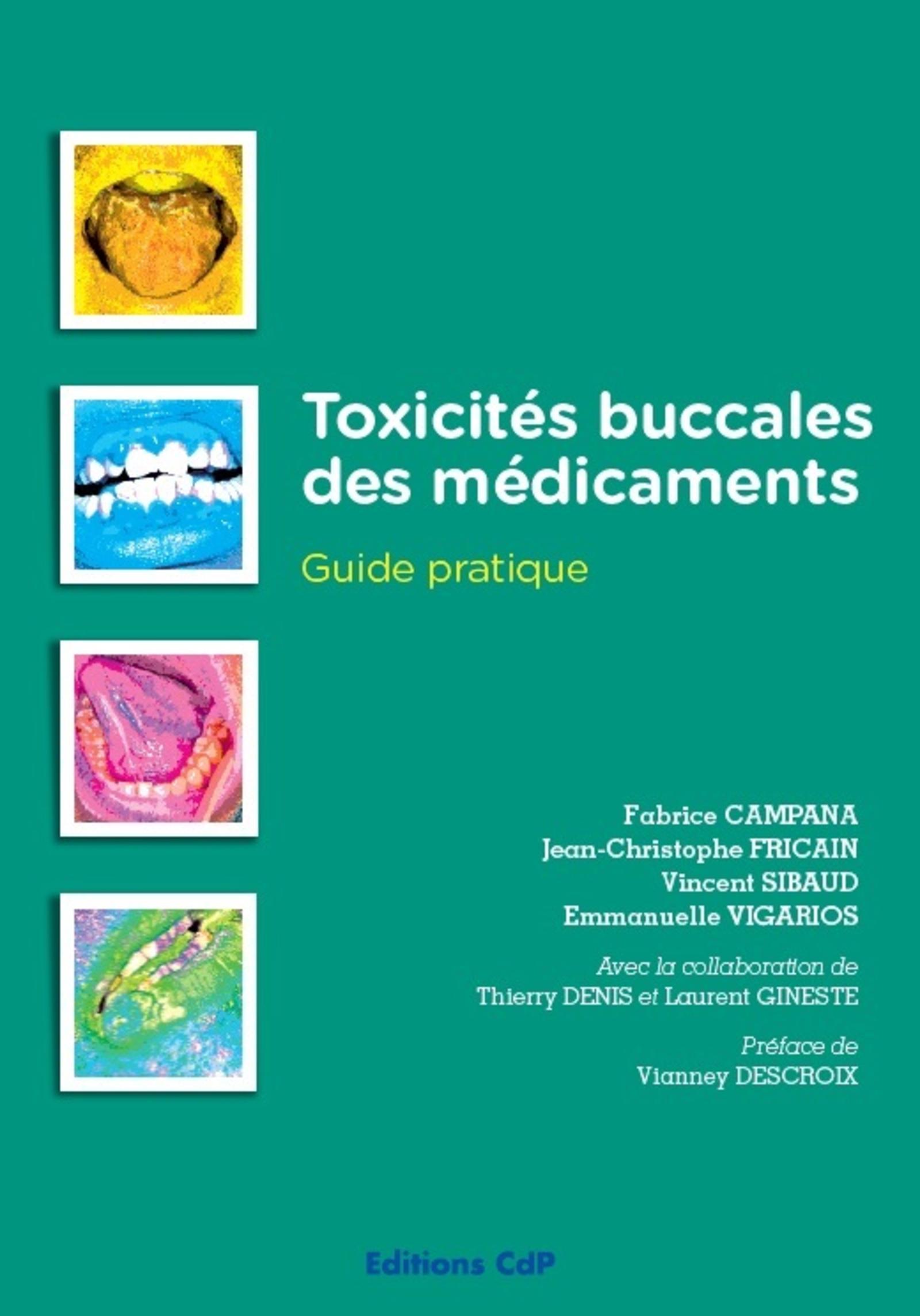 Toxicités buccales des médicaments