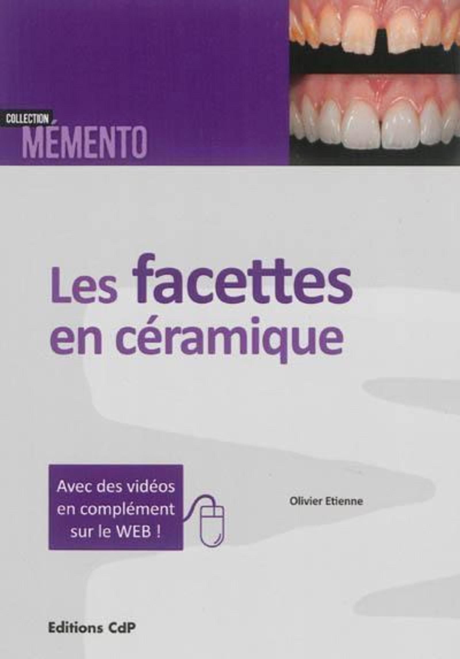 Les facettes en céramique