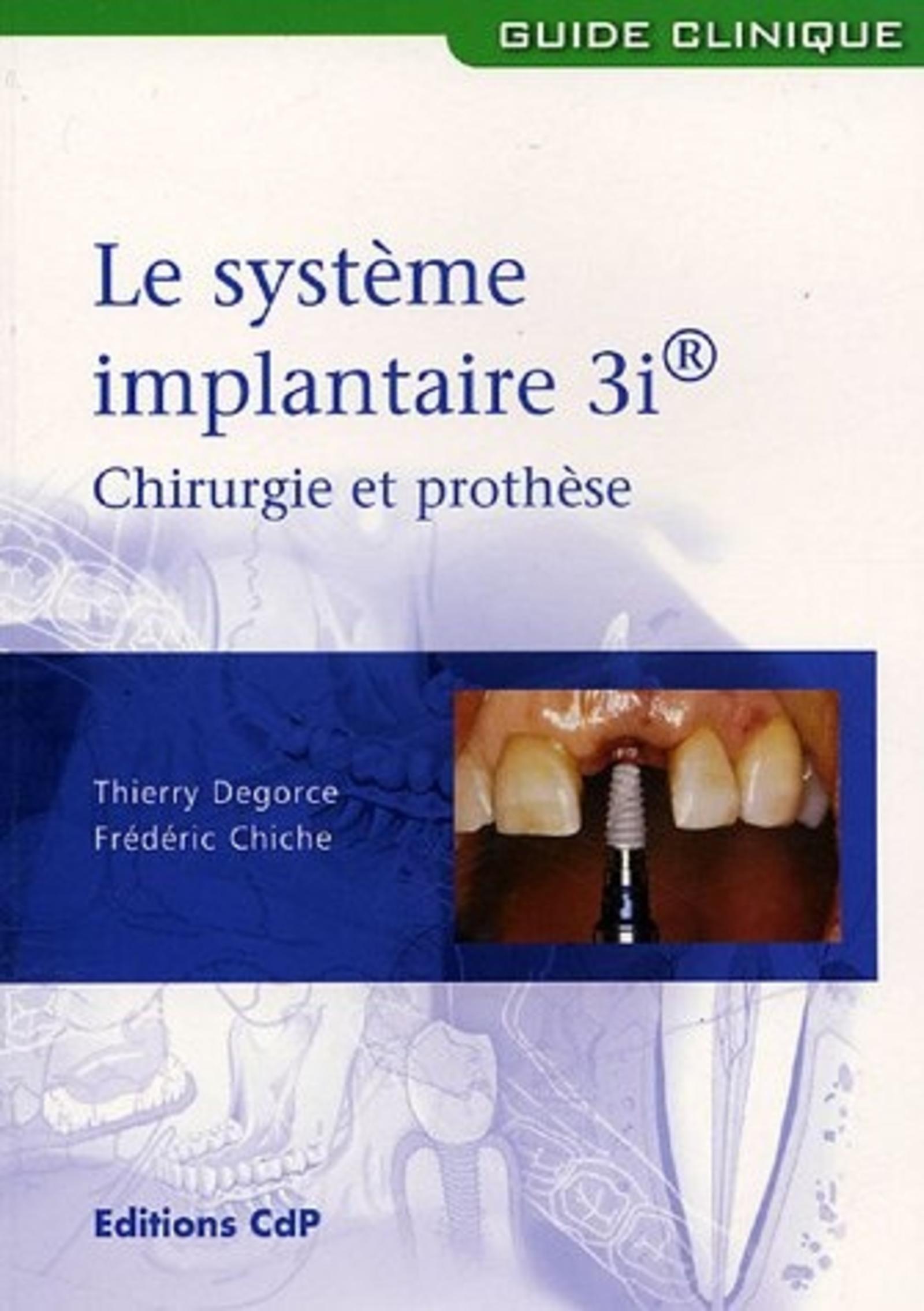 LE SYSTEME IMPLANTAIRE 3I