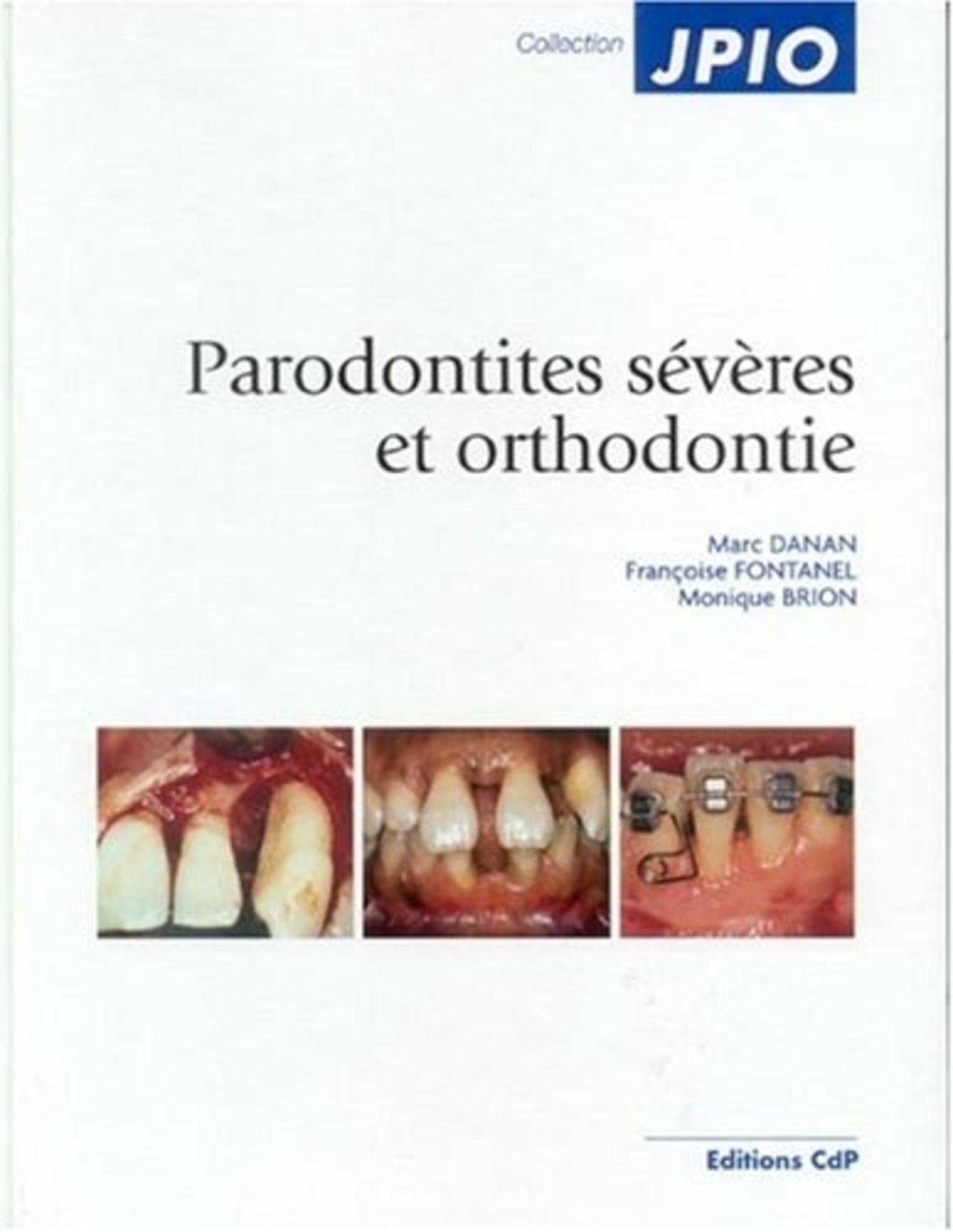 PARODONTITES SEVERES ET ORTHODONTIE