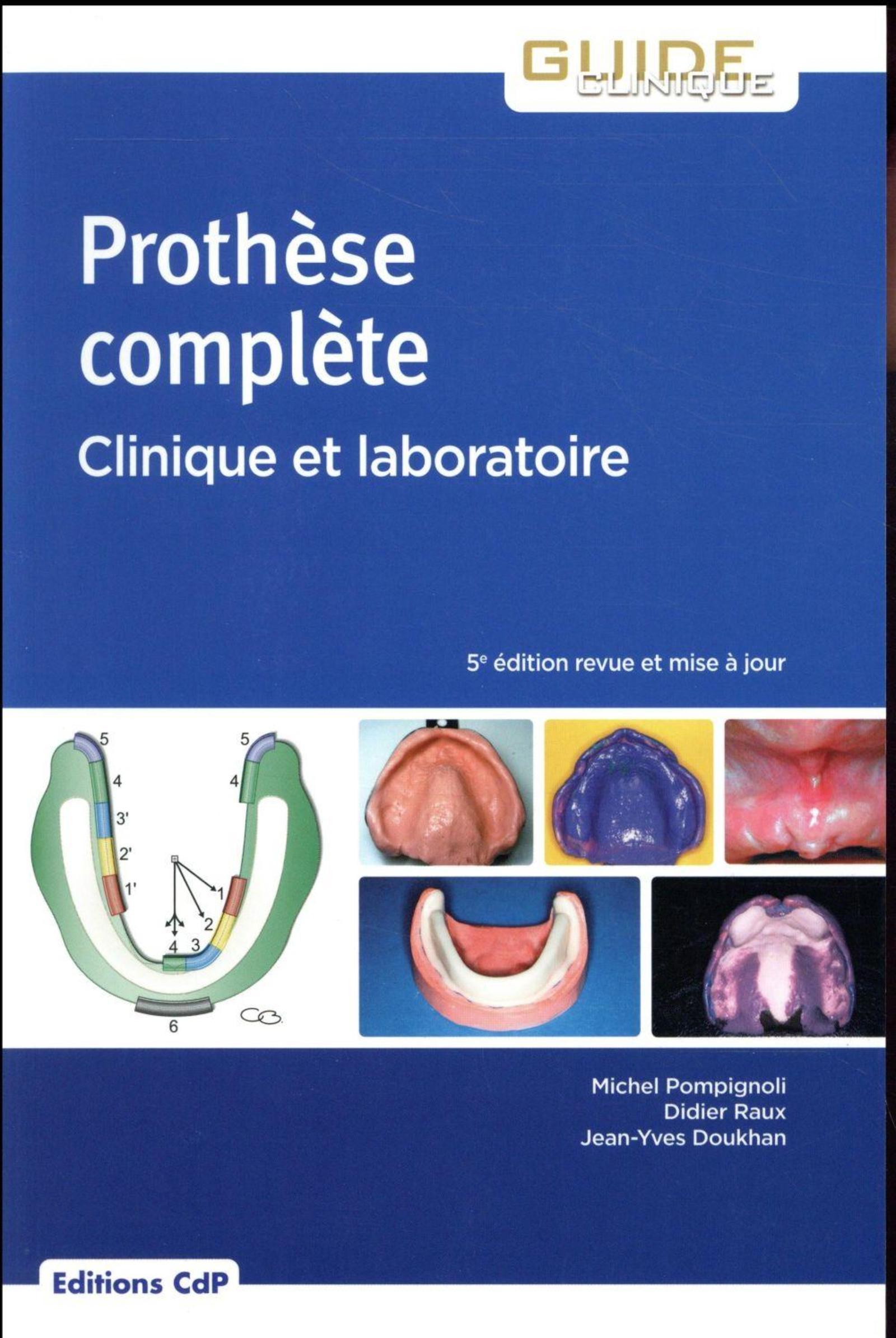 Prothèse complète