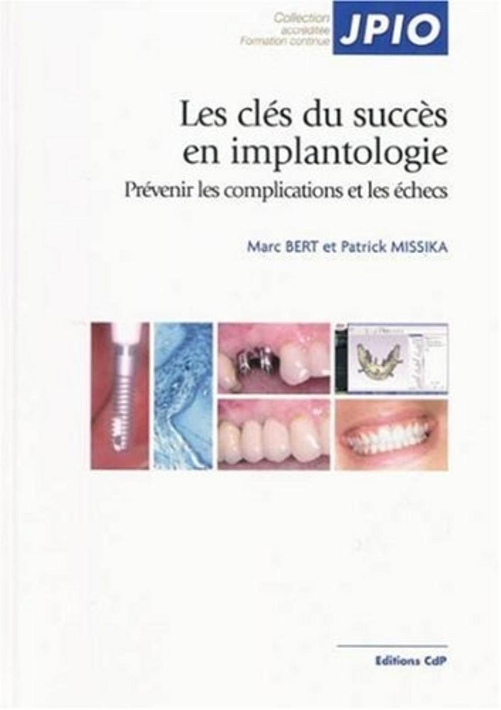 Les clés du succès en implantologie