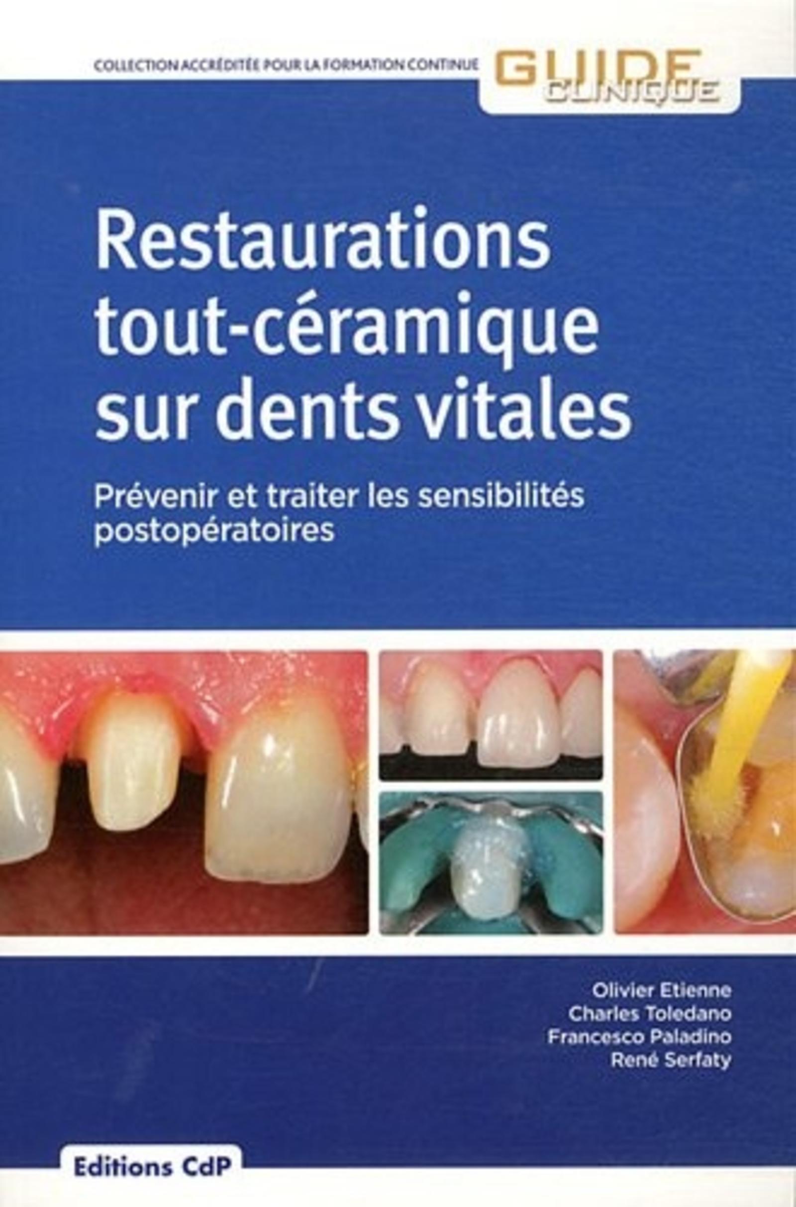 RESTAURATIONS TOUT CERAMIQUE SUR DENTS VITALES
