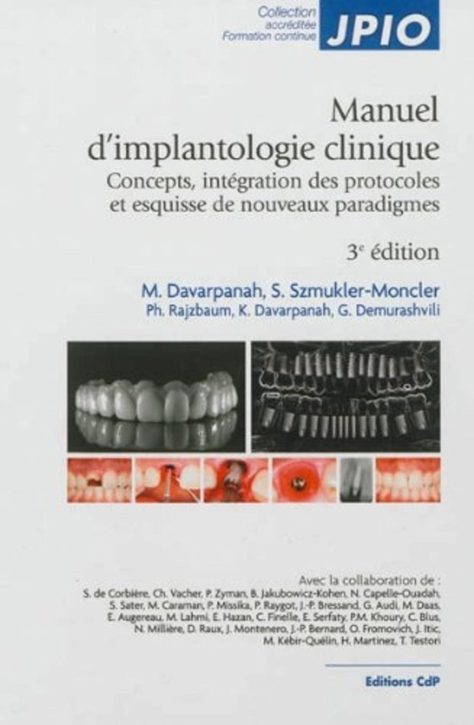 MANUEL D IMPLANTOLOGIE CLINIQUE 3EME ED