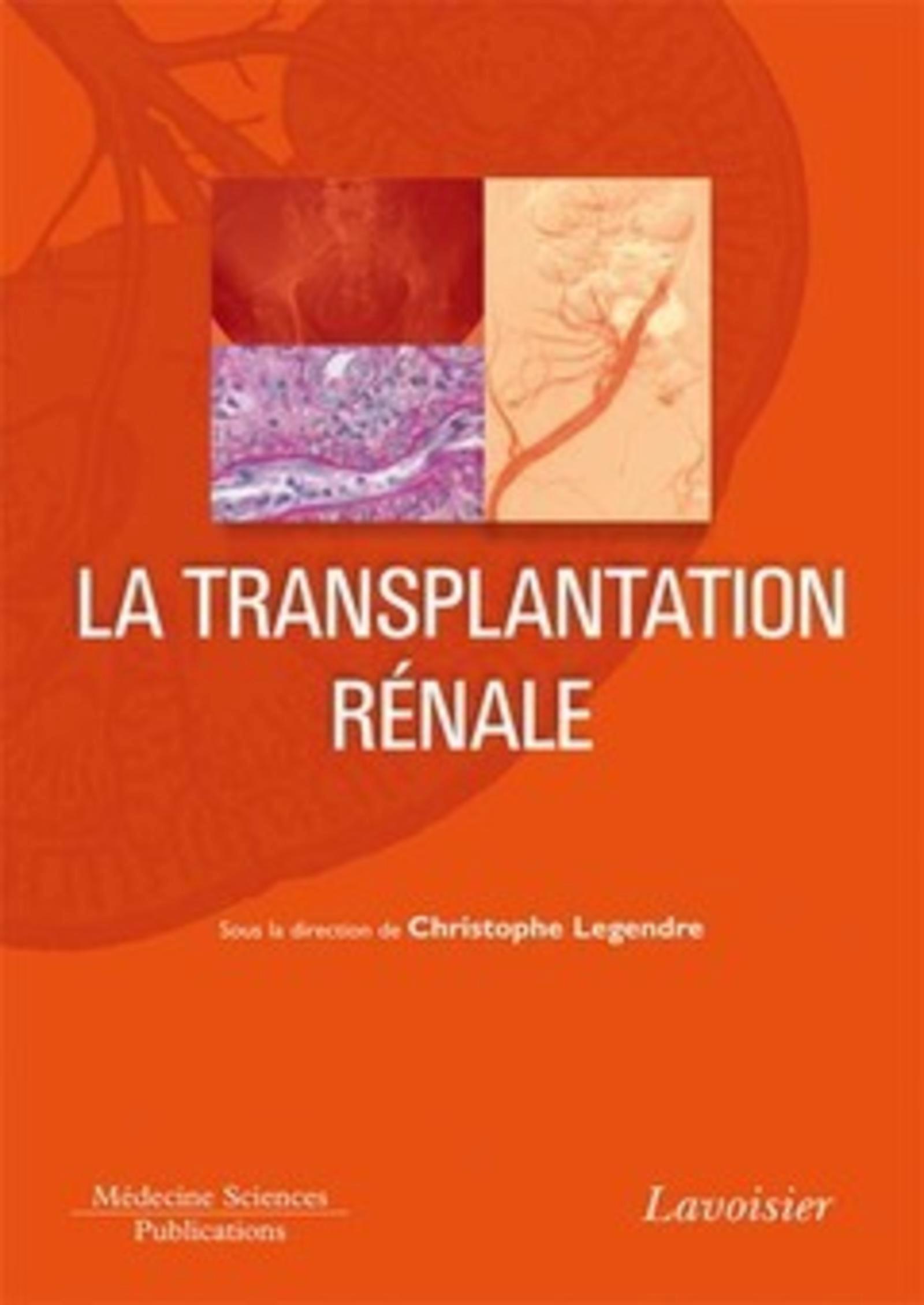 La transplantation rénale