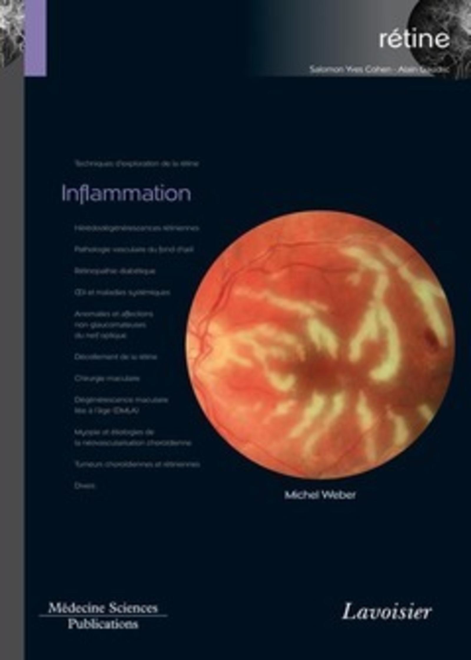 Inflammation (volume 4 - coffret Rétine)