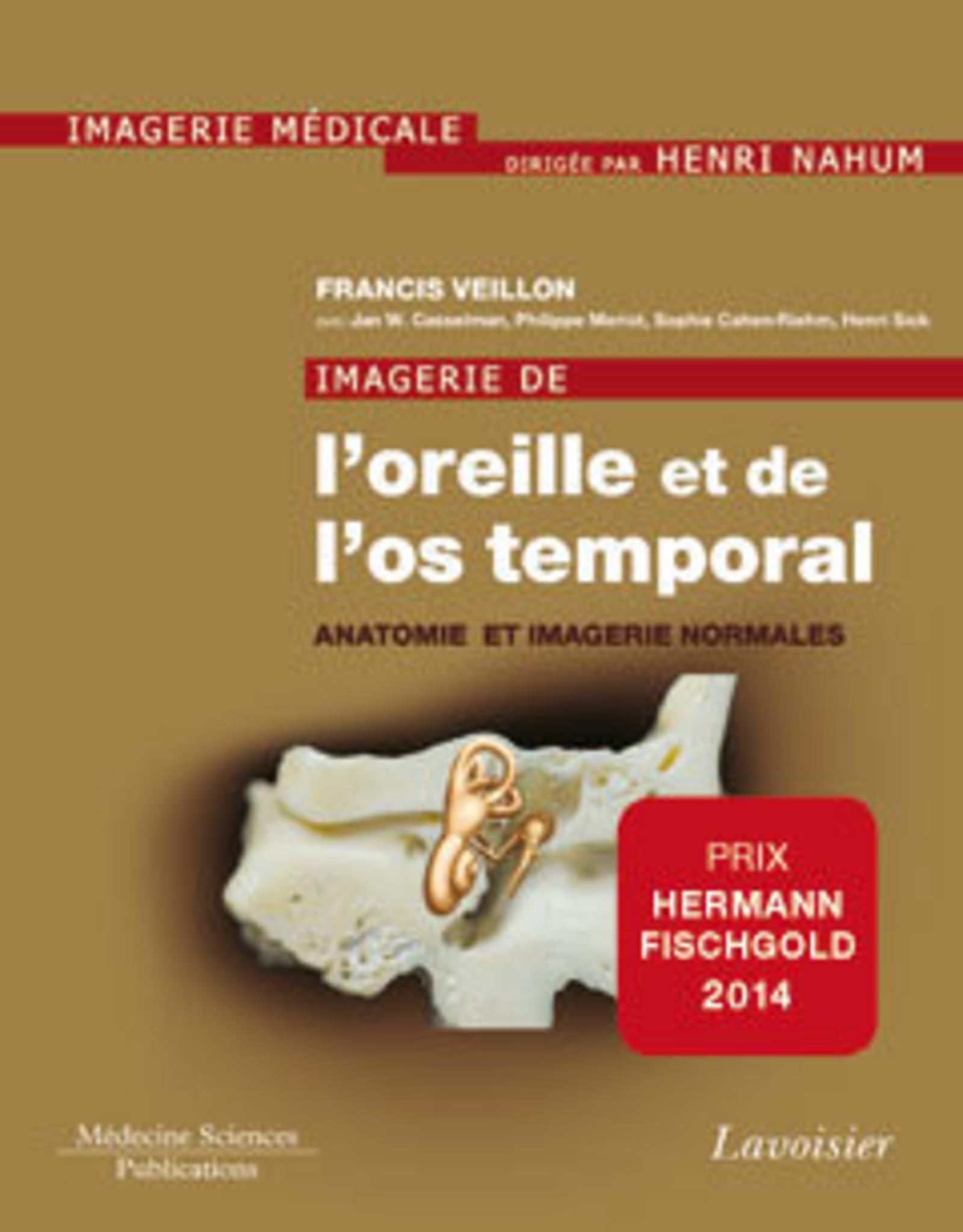 Imagerie de l'oreille et de l'os temporal - Volume 1. Anatomie et imagerie normales