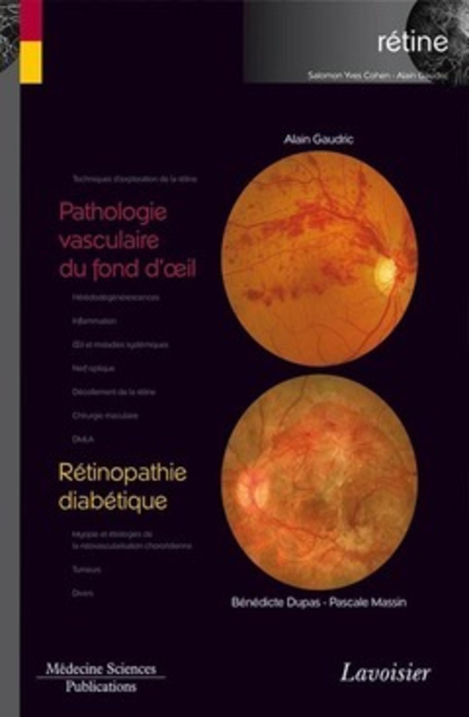 Pathologie vasculaire du fond d'oeil / Rétinopathie diabétique (volume 3 - coffret Rétine)
