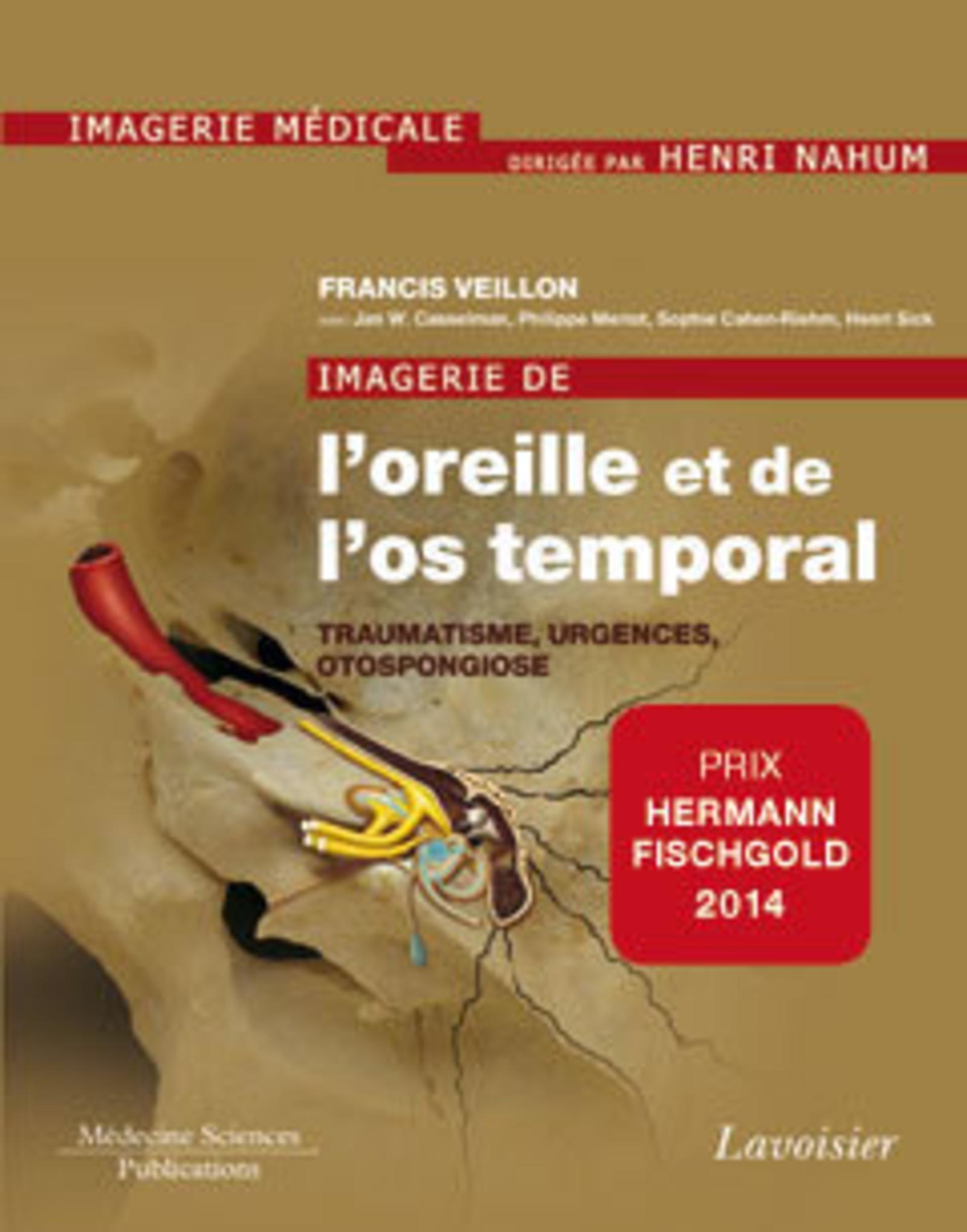 Imagerie de l'oreille et de l'os temporal - Volume 3. Traumatologie, urgences, otospongiose