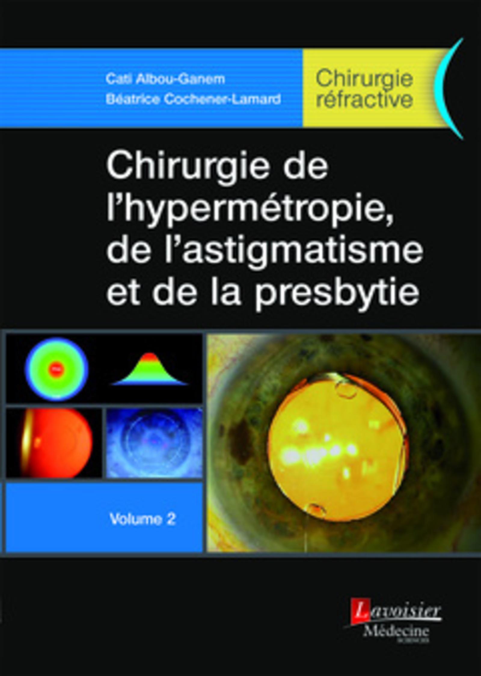 Chirurgie de l'hypermétropie, de l'astigmatisme et de la presbytie - Volume 2 (Chirurgie réfractive)