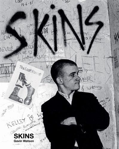 Gavin Watson Skins /anglais
