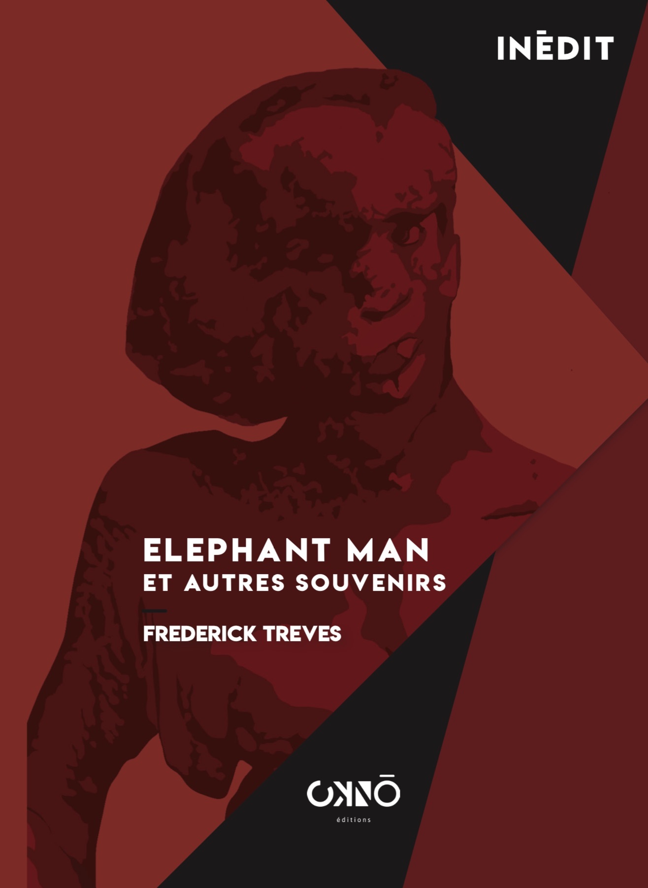 Elephant Man