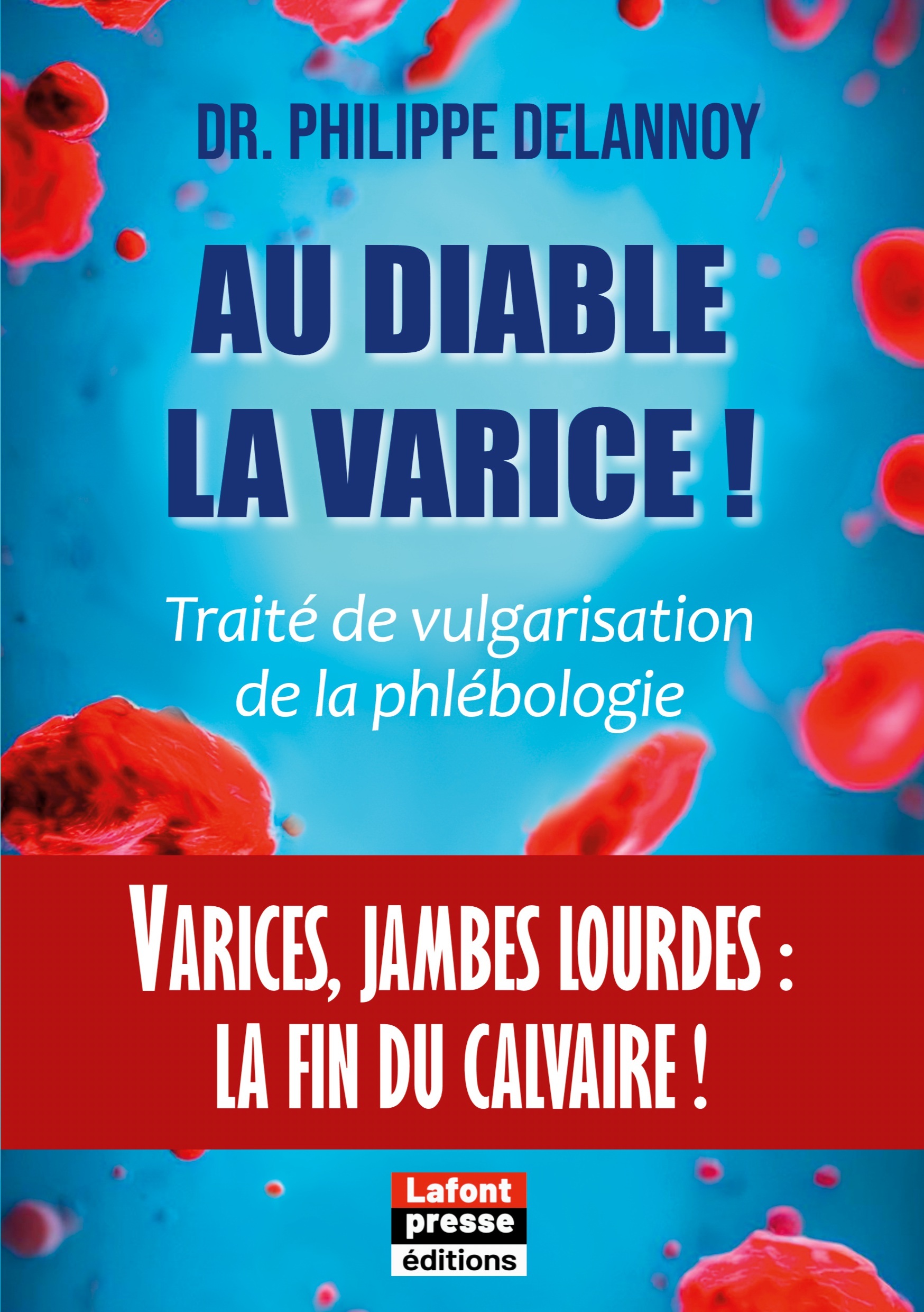 Au diable la varice !