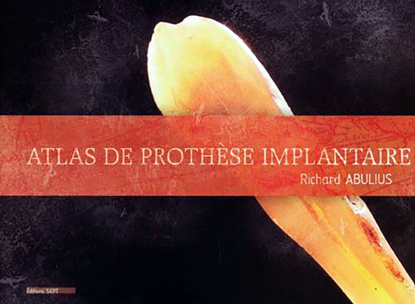 ATLAS DE PROTHESE IMPLANTAIRE
