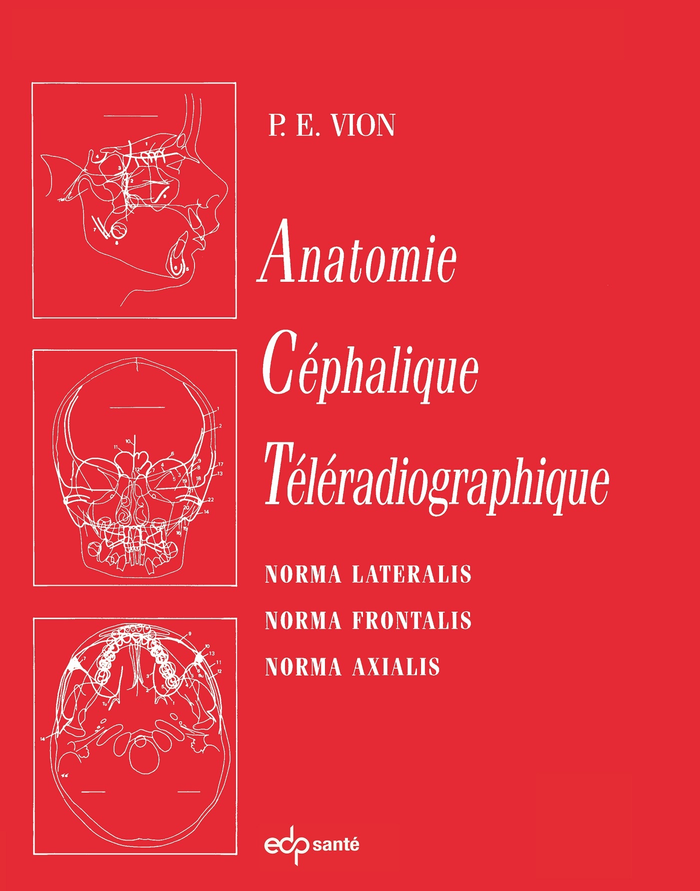 Anatomie Céphalique Téléradiographique