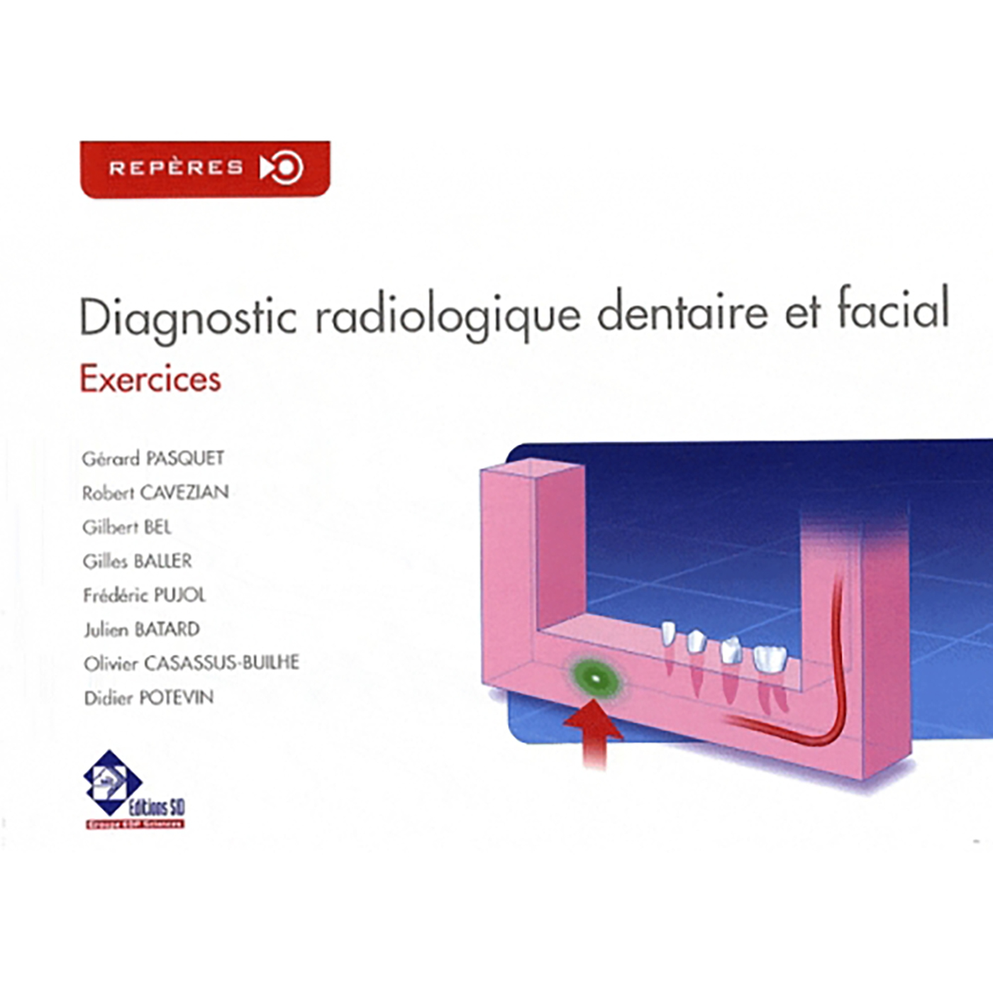 DIAGNOSTIC RADIOLOGIQUE DENTAIRE ET FACIAL : EXERCICES