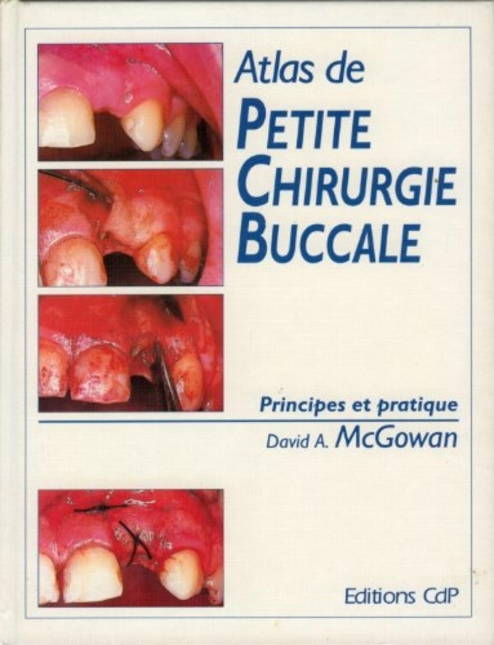 ATLAS DE PETITE CHIRURGIE BUCCALE PRINCIPES ET PRATIQUE