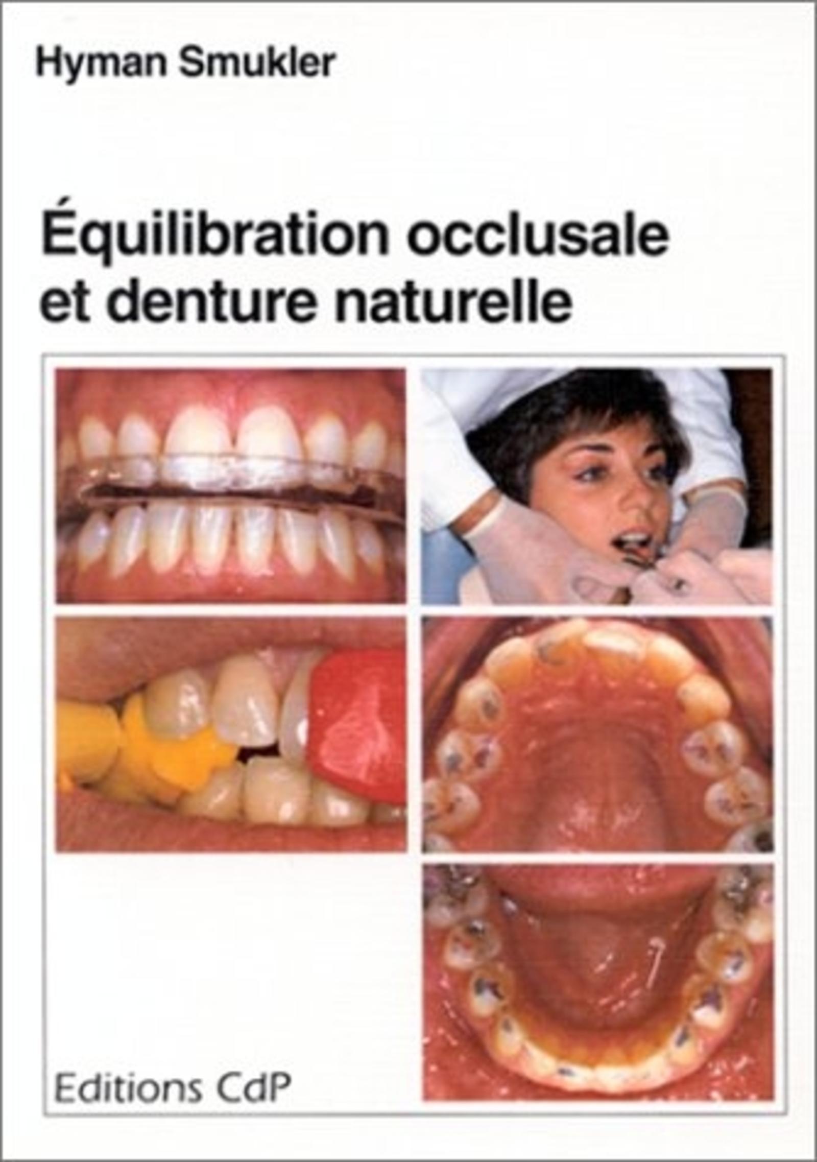 EQUILIBRATION OCCLUSALE ET DENTURE NATURELLE