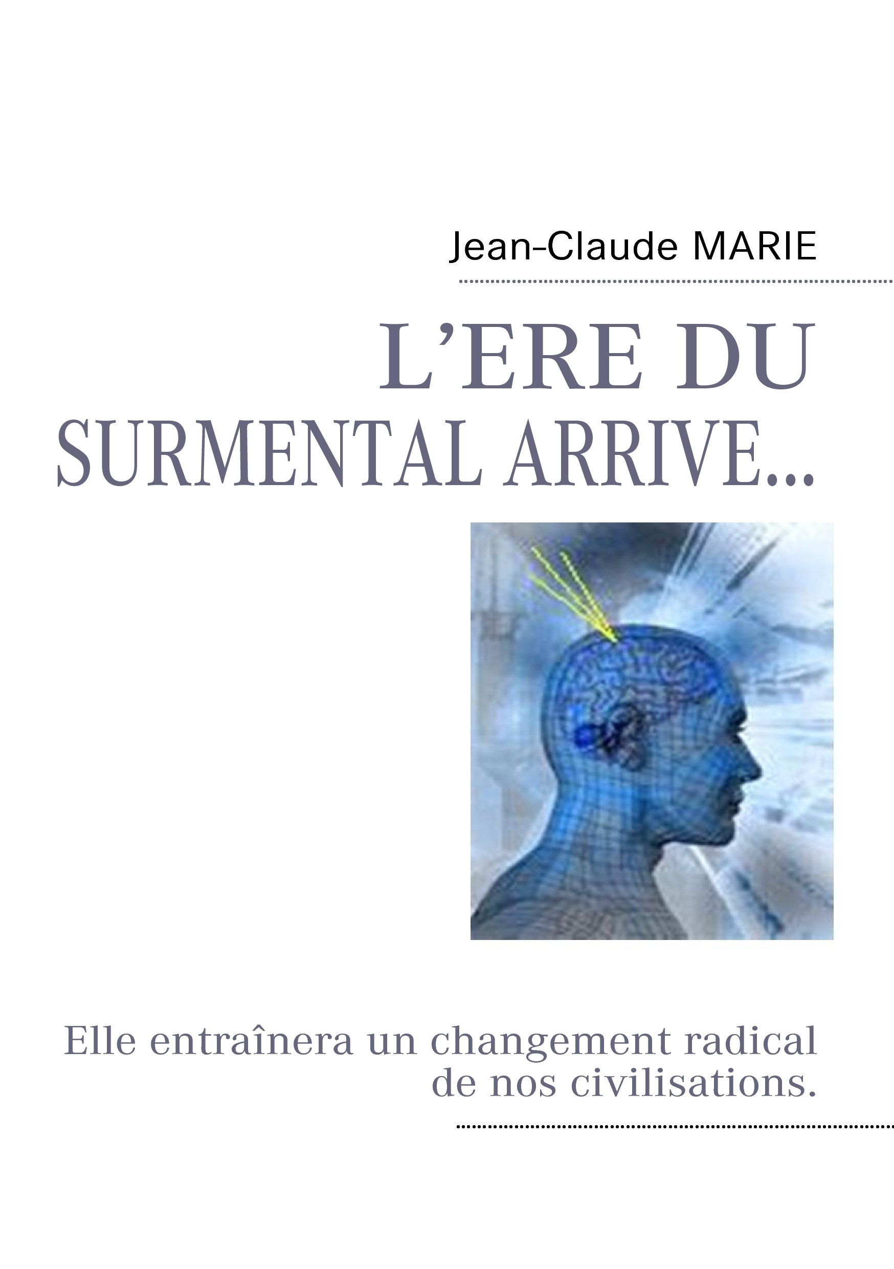 L'ERE DU SURMENTAL ARRIVE...