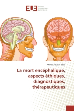 La mort encéphalique, aspects éthiques, diagnostiques, thérapeutiques