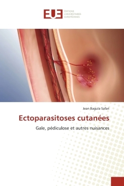 Ectoparasitoses cutanées