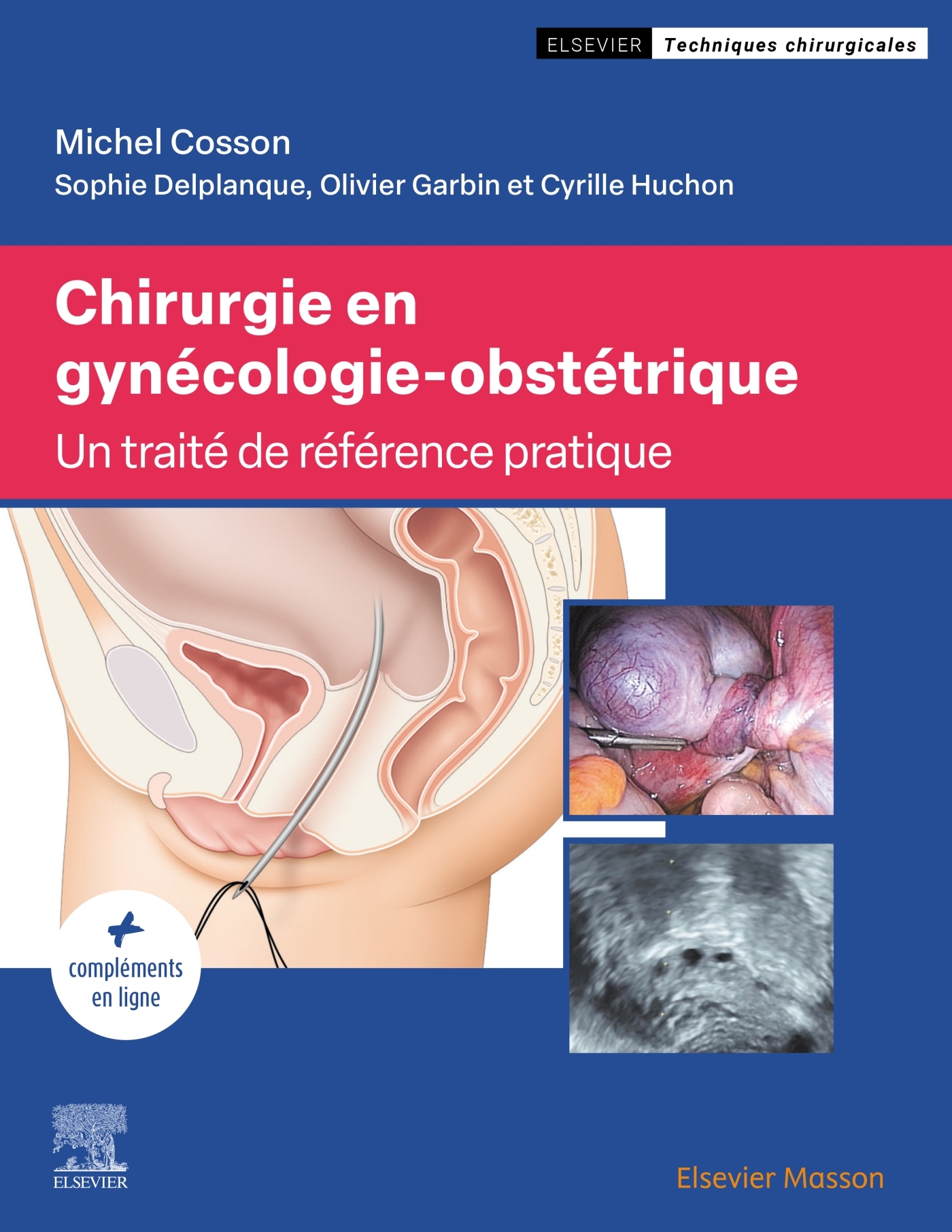 Chirurgie en gynécologie-obstétrique