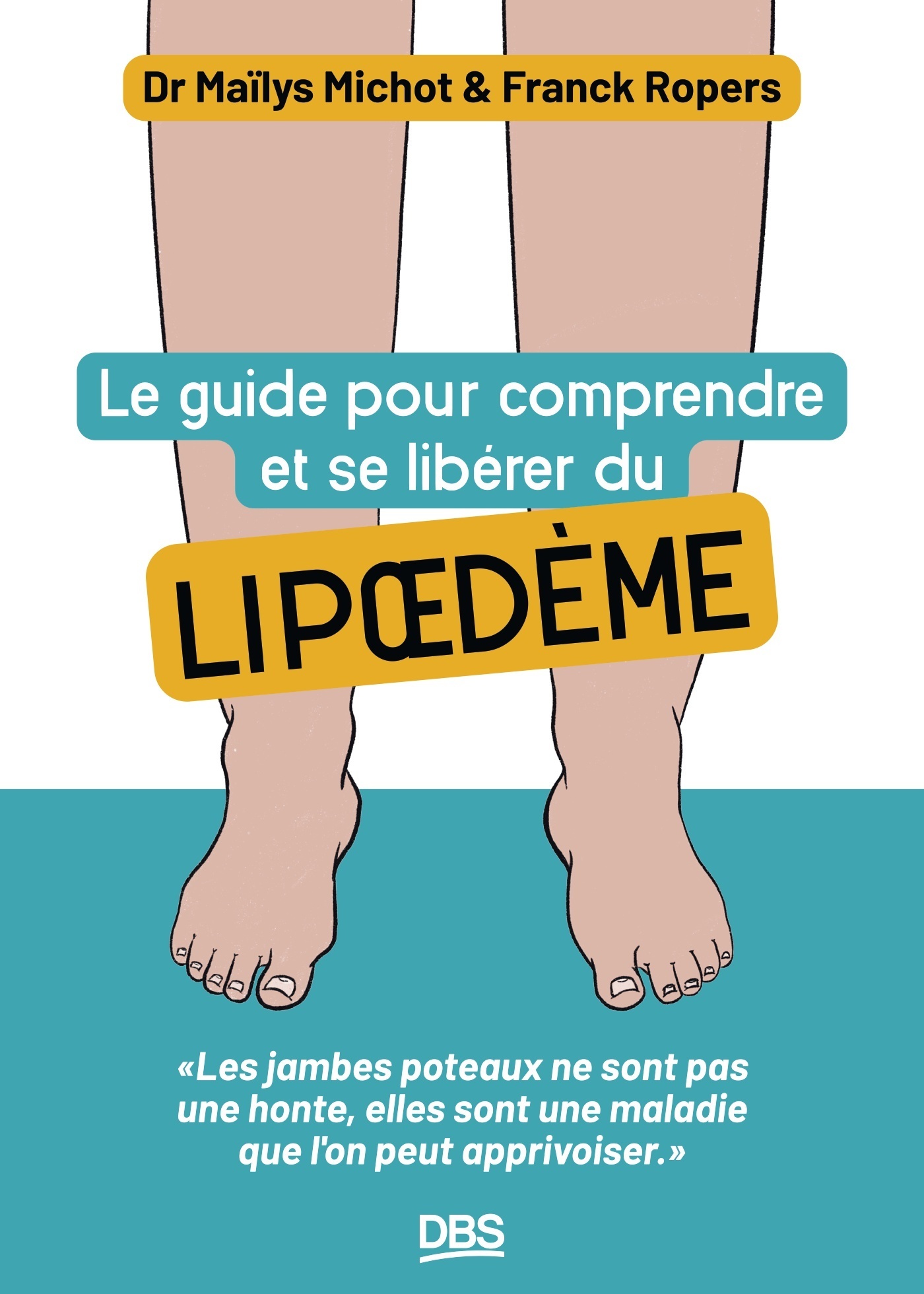 Le guide pour comprendre et se libérer du lipoedème - Les jambes poteaux ne sont pas une honte, elles sont une maladie que l'on peut apprivoiser