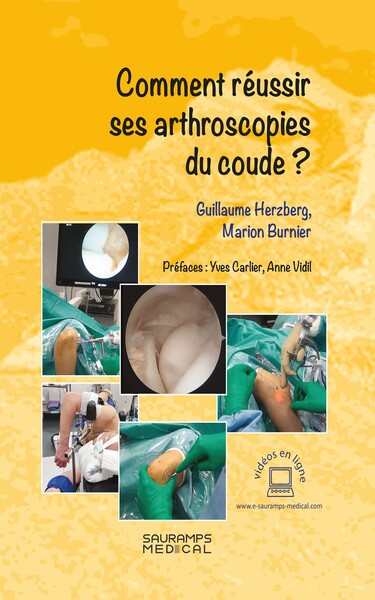 Comment réussir ses arthroscopies du coude ?