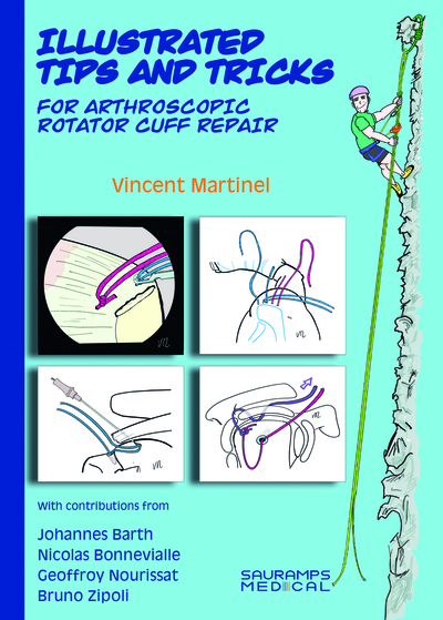 Illustrated tips and tricks : for arthroscopic rotator cuff repair