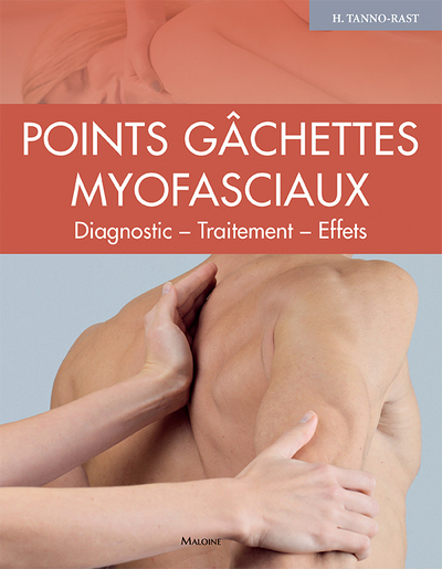 POINTS GACHETTES MYOFASCIAUX DIAGNOSTIC, TRAITEMENT, EFFETS