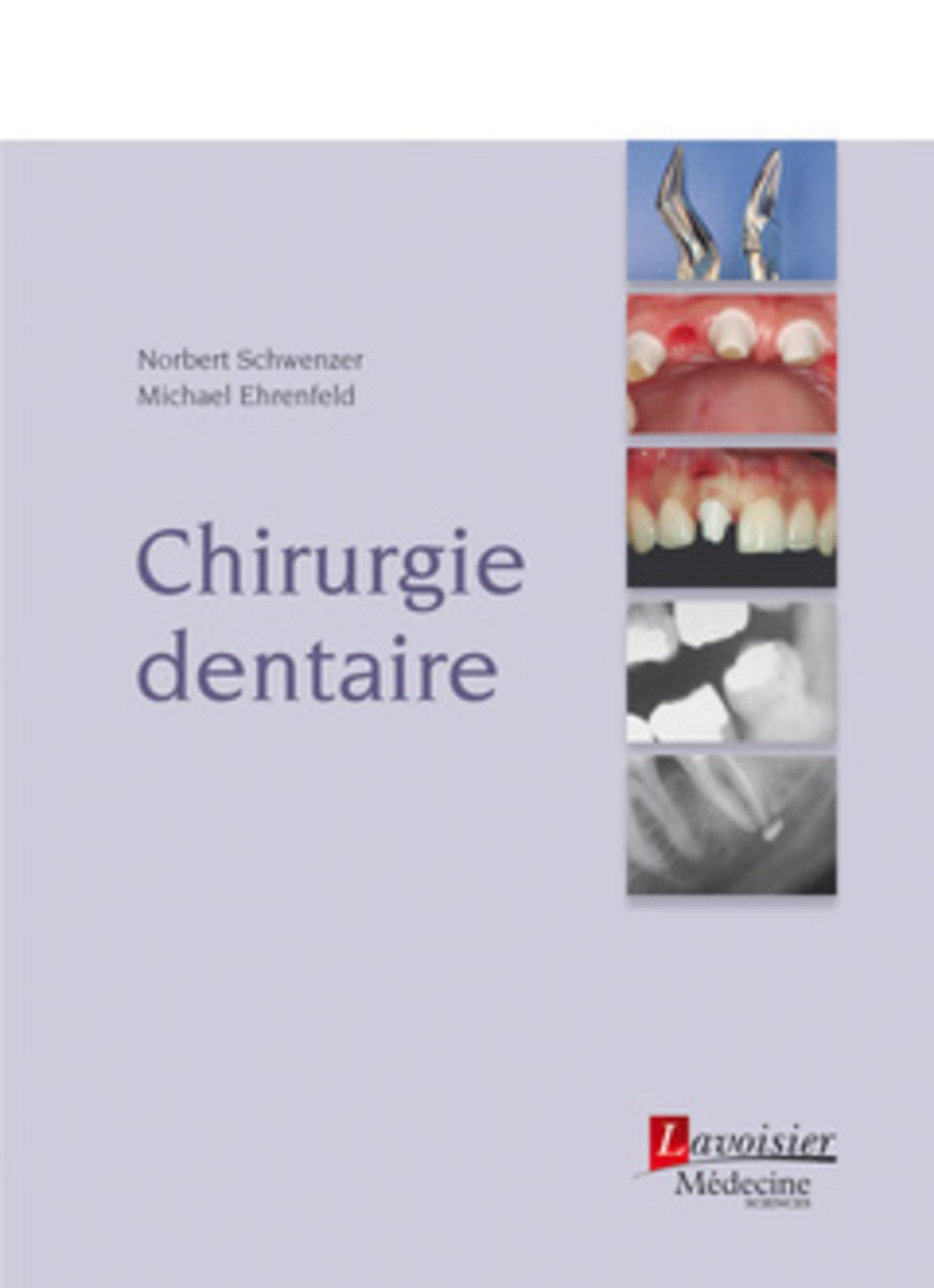 CHIRURGIE DENTAIRE