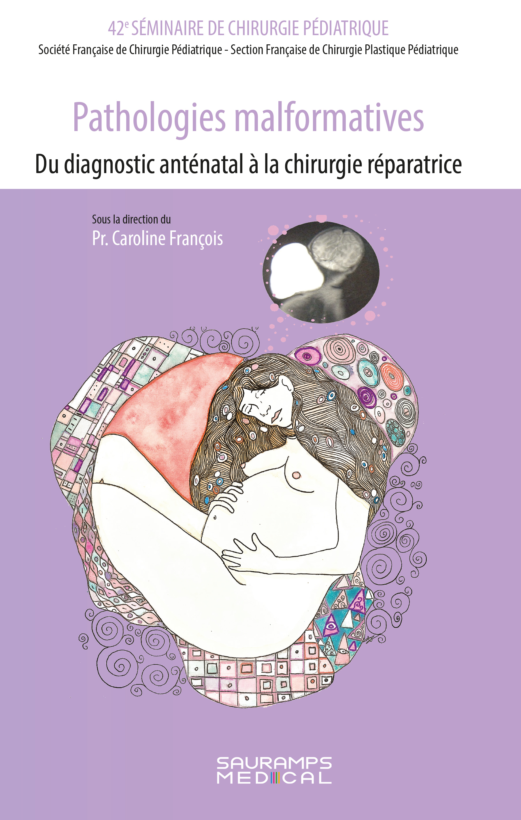 PATHOLOGIES MALFORMATIVES-DU DIAGNOSTIC ANTENATAL A LA CHIRURGIE REPARATRICE