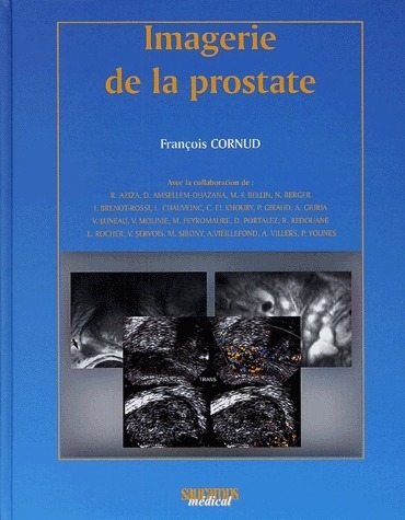 IMAGERIE DE LA PROSTATE