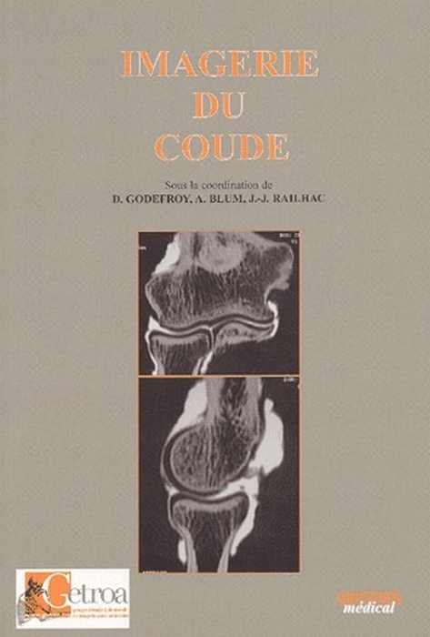 IMAGERIE DU COUDE