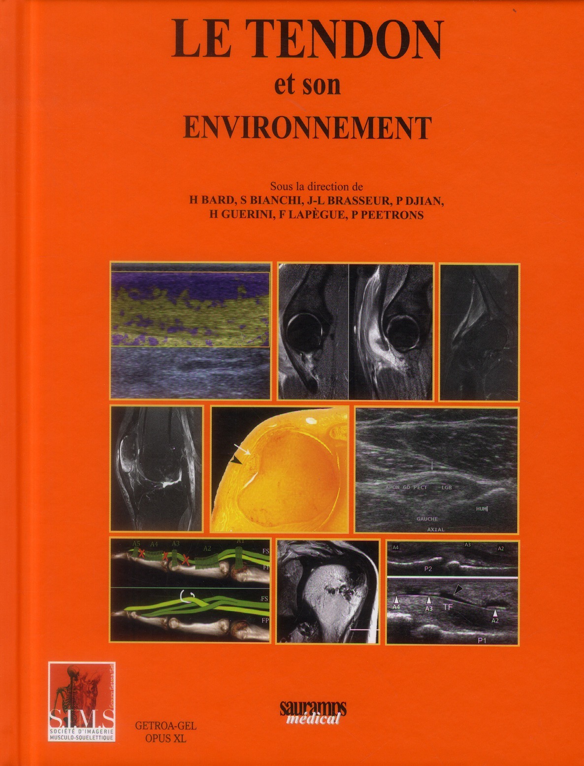 TENDON ET SON ENVIRONNEMENT - SIMS