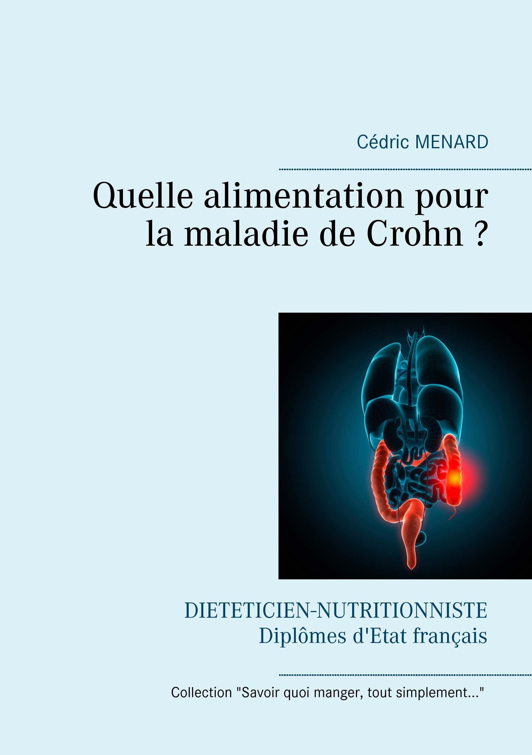 QUELLE ALIMENTATION POUR LA MALADIE DE CROHN